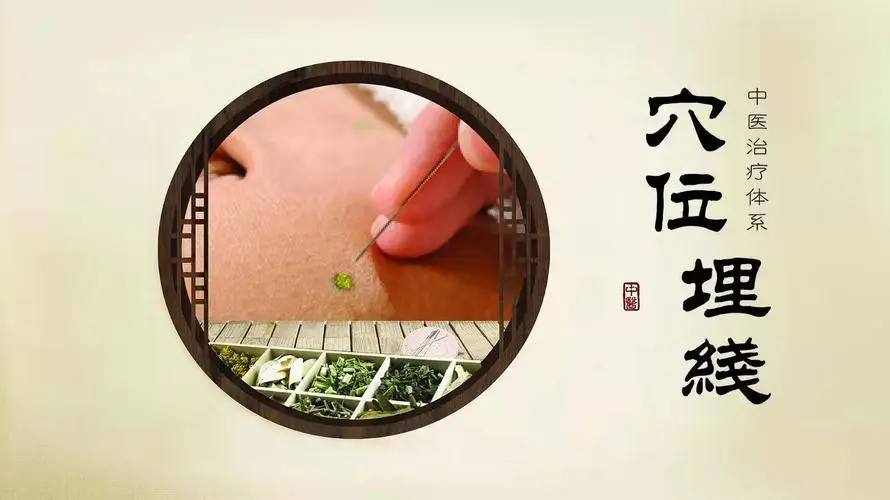 埋线疗法可以治疗哪些疾病