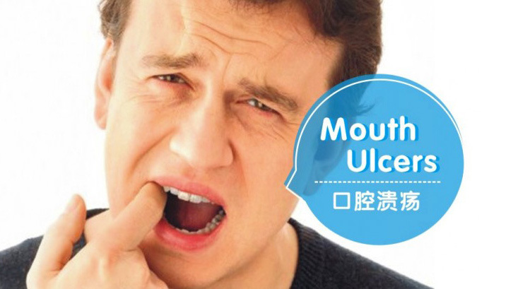 口腔溃疡口臭胃疼，如何缓解？